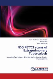 FDG PET/CT scans of Extrapulmonary Tuberculosis, Abdul Razak Hairil Rashmizal