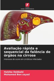 Avalia?o rpida e sequencial da fal?ncia de rg?os na cirrose, Debbabi Habiba