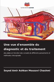 Une vue d'ensemble du diagnostic et du traitement, Chashmi Seyed Amir Ashkan Mousavi