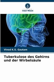 Tuberkulose des Gehirns und der Wirbelsule, Gautam Vinod K.S.