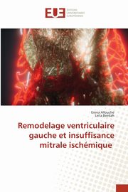 Remodelage ventriculaire gauche et insuffisance mitrale ischmique, Allouche Emna