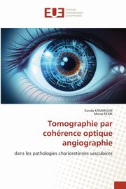 Tomographie par cohrence optique angiographie, KAMMOUN Sonda