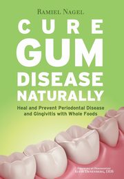 Cure Gum Disease Naturally, Nagel Ramiel