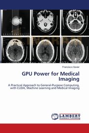 GPU Power for Medical Imaging, Xavier Francisco