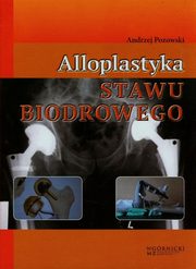 ksiazka tytu: Alloplastyka stawu biodrowego autor: Pozowski Andrzej