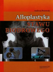Alloplastyka stawu biodrowego, Pozowski Andrzej