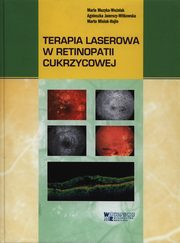 Terapia laserowa w retinopatii cukrzycowej, Muzyka-Woniak Maria, Jamrozy-Witkowska Agnieszka, Misiuk-Hojo Marta
