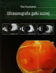 ksiazka tytu: Ultrasonografia gaki ocznej autor: Fryczkowski Piotr