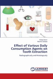 Effect of Various Daily Consumption Agents on Tooth Extraction, Samir Walaa