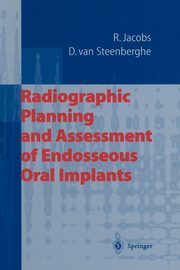 Radiographic Planning and Assessment of Endosseous Oral Implants, Jacobs Reinhilde