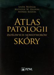 Atlas patologii zoliwych nowotworw skry, Woniak Leszek, Zieliski Krzysztof W., Kaszuba Andrzej