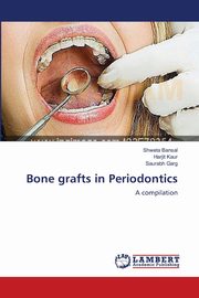 Bone grafts in Periodontics, Bansal Shweta