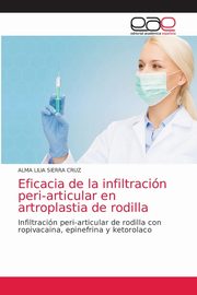 Eficacia de la infiltracin peri-articular en artroplastia de rodilla, SIERRA CRUZ ALMA LILIA