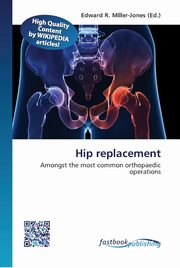 Hip replacement, 
