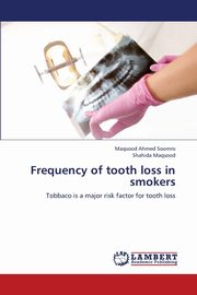 Frequency of Tooth Loss in Smokers, Soomro Maqsood Ahmed