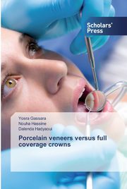 Porcelain veneers versus full coverage crowns, Gassara Yosra