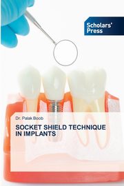 ksiazka tytu: SOCKET SHIELD TECHNIQUE IN IMPLANTS autor: Boob Dr. Palak