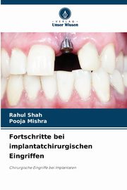 Fortschritte bei implantatchirurgischen Eingriffen, SHAH RAHUL