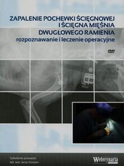 ksiazka tytu: Zapalenie pochewki cignowej icigna minia dwugowego ramienia autor: Jerzy Kirstein