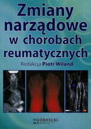 Zmiany narzdowe w chorobach reumatycznych, Wiland Piotr