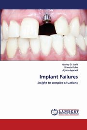 Implant Failures, Joshi Akshay D.