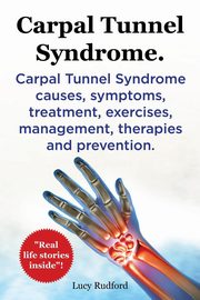 Carpal Tunnel Syndrome, Cts. Carpal Tunnel Syndrome Cts Causes, Symptoms, Treatment, Exercises, Management, Therapies and Prevention., Rudford Lucy