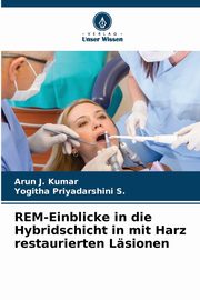 REM-Einblicke in die Hybridschicht in mit Harz restaurierten Lsionen, J. Kumar Arun