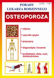Osteoporoza, 
