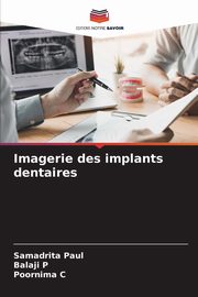 Imagerie des implants dentaires, Paul Samadrita