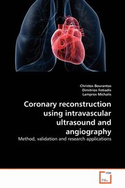 Coronary reconstruction using intravascular ultrasound and angiography, Bourantas Christos