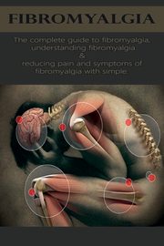 Fibromyalgia, Anthony David