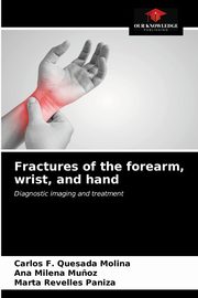 Fractures of the forearm, wrist, and hand, Quesada Molina Carlos F.