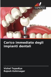 Carico immediato degli impianti dentali, Tapadiya Vishal
