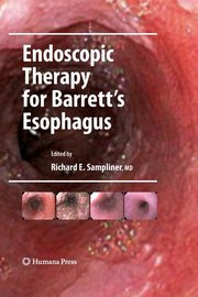 Endoscopic Therapy for Barrett's Esophagus, 