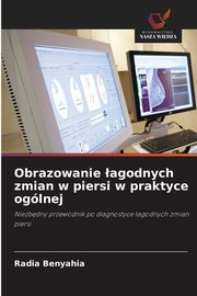 Obrazowanie agodnych zmian w piersi w praktyce oglnej, BENYAHIA Radia
