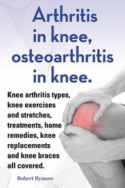 Arthritis in knee, osteoarthritis in knee. Knee arthritis types, knee exercises and stretches, treatments, home remedies, knee replacements and knee braces all covered., Rymore Robert