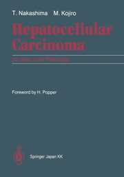 Hepatocellular Carcinoma, Nakashima Toshiro