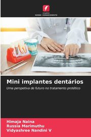 Mini implantes dentrios, Naina Himaja