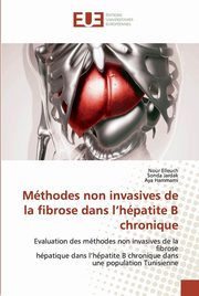 Mthodes non invasives de la fibrose dans l'hpatite B chronique, Elleuch Nour