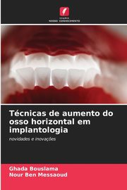 Tcnicas de aumento do osso horizontal em implantologia, Bouslama Ghada