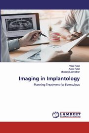 Imaging in Implantology, Patel Vilas