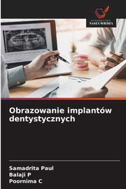 Obrazowanie implantw dentystycznych, Paul Samadrita