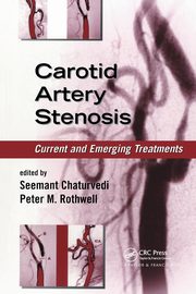 Carotid Artery Stenosis, 