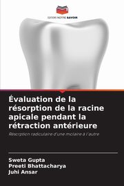 valuation de la rsorption de la racine apicale pendant la rtraction antrieure, Gupta Sweta