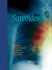 Sarcoidosis, 