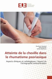 Atteinte de la cheville dans le rhumatisme psoriasique, Gassara Zouhour