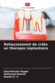 Rehaussement de cr?te en thrapie implantaire, Hegde Shashikanth