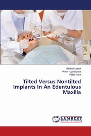 Tilted Versus Nontilted Implants In An Edentulous Maxilla, Punjani Shikha