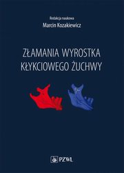 Zamania wyrostka kykciowego uchwy, 