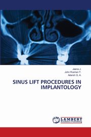 SINUS LIFT PROCEDURES IN IMPLANTOLOGY, J. Jeena
